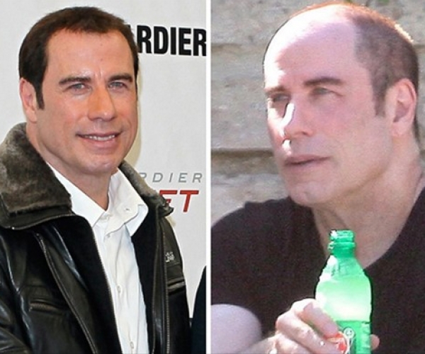 John Travolta Saç Ektirdi
