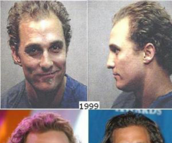 Matthew Mcconaughey Saç Ektirdi