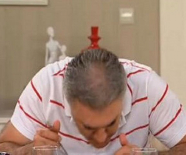 Tamer Karadağlı Saç Ektirdi